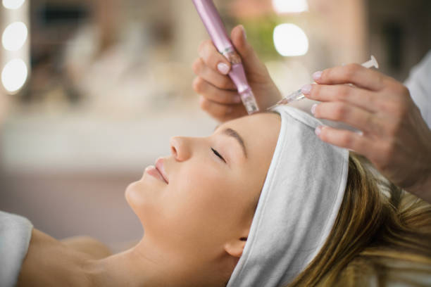 microneedling naples fl